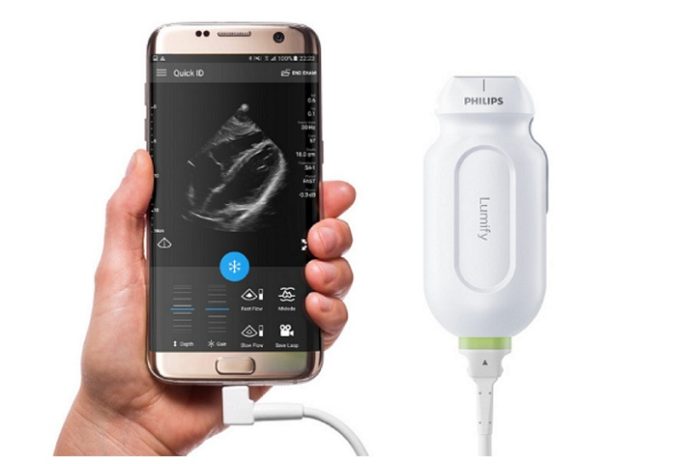 Philips expands access to hemodynamics at point-of-care for real-time blood flow assessment on Handheld Ultrasound - Lu