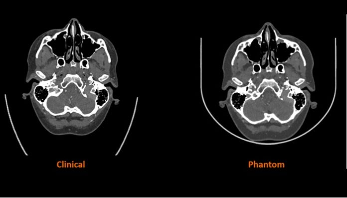 Stratasys Partners with Siemens Healthineers in Landmark Research Project to Advance Medical Imaging