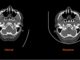 Stratasys Partners with Siemens Healthineers in Landmark Research Project to Advance Medical Imaging