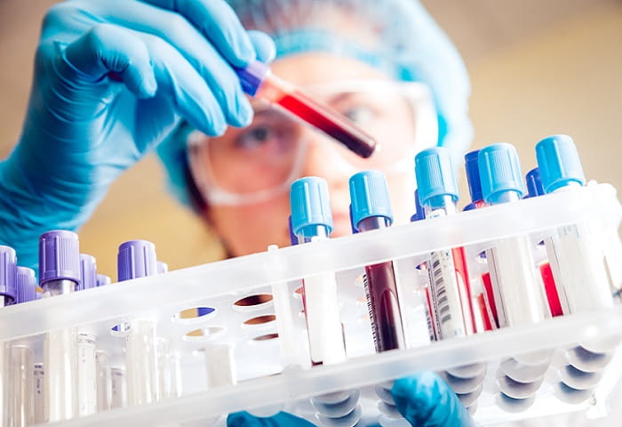 Blood Preparation Market Detailed Analysis and Forecast by 2025