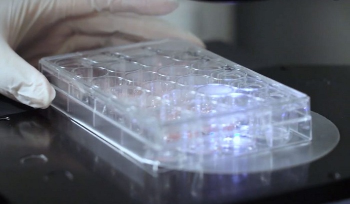 Mount Sinai Discovers New Drug Combo to Induce High Rates of Human Beta Cell Regeneration