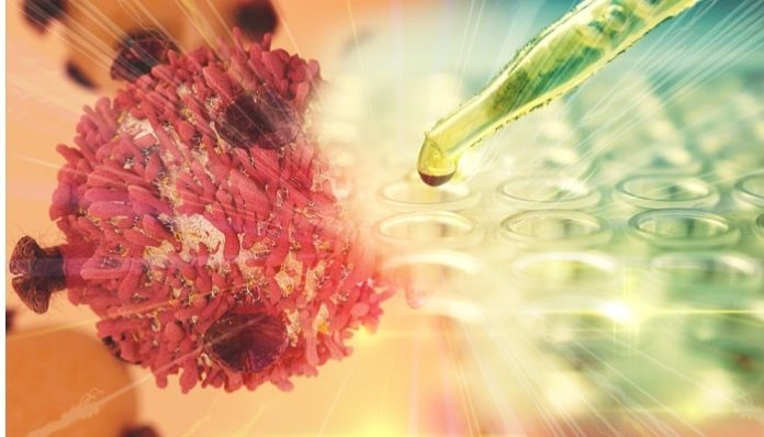 Queen's University leading clinical trial on cell therapy treatment for COVID19 patients 