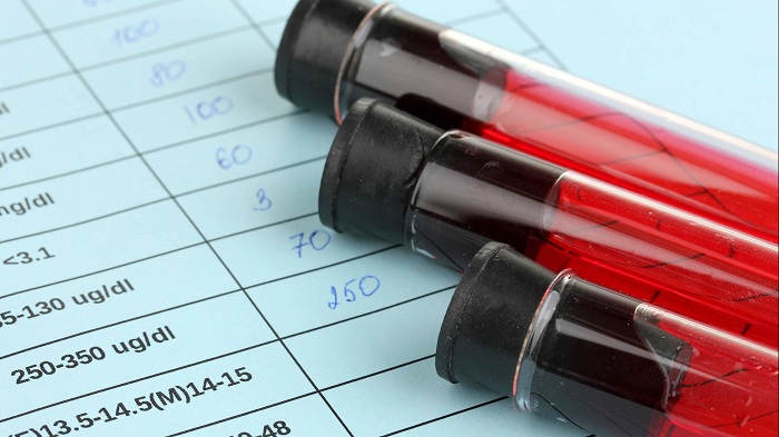 Majority of Americans taking Blood Thinners indicate the fear of major bleeding.