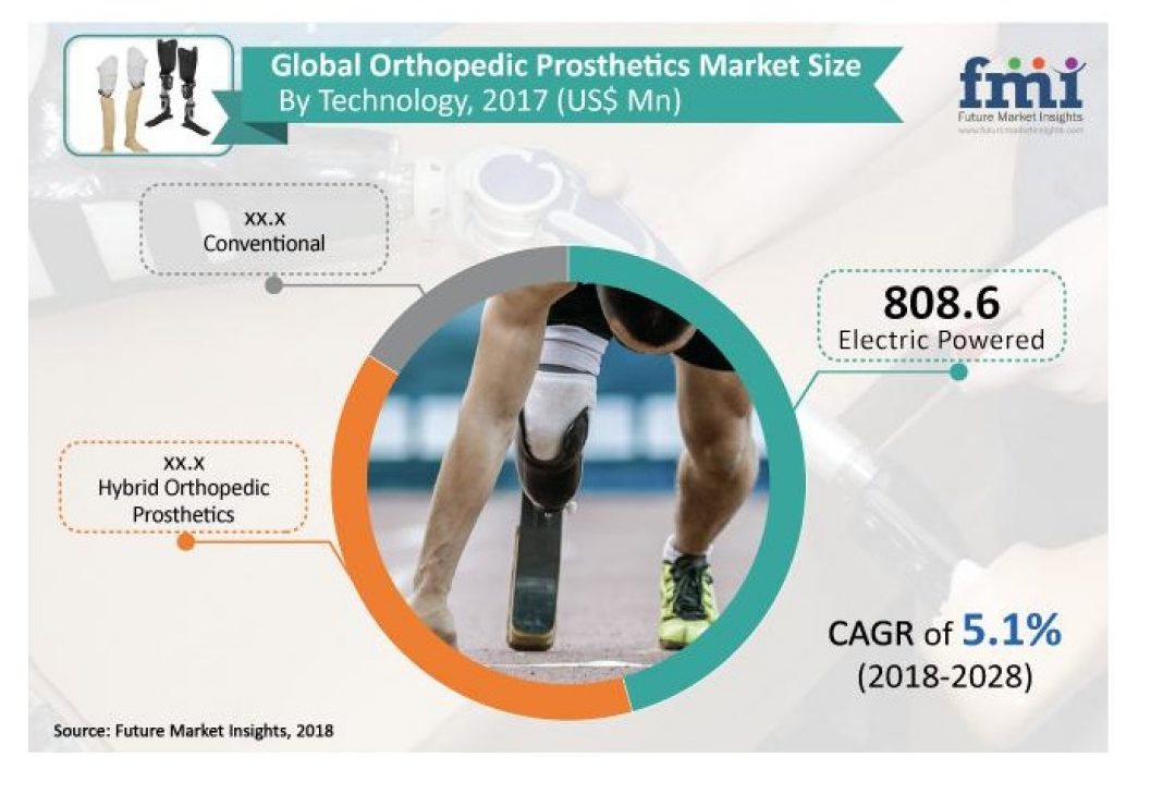 Custom-made Orthopedic Prosthetics